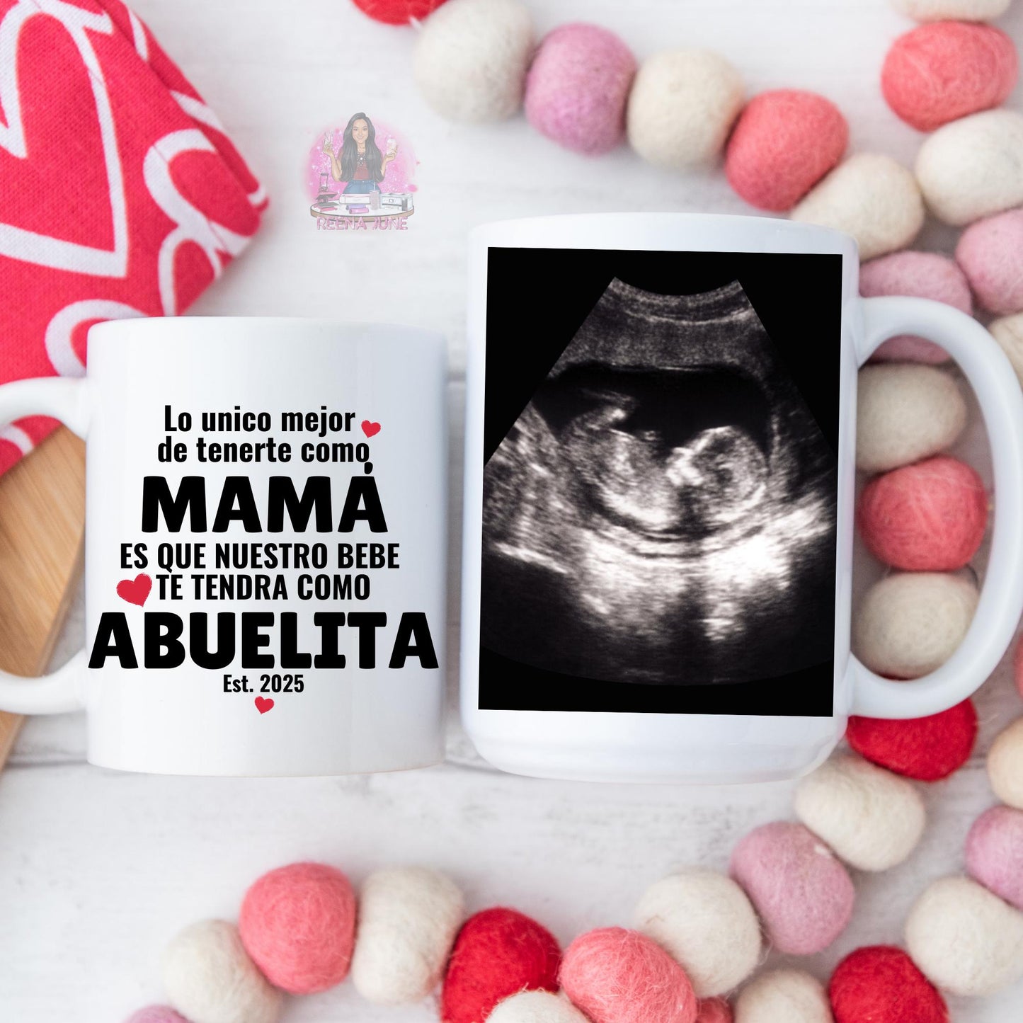 Custom Ultrasound Mug – Personalized Sonogram Mug – Pregnancy Announcement Gift – New Mom or Dad Gift – Baby Reveal Coffee Cup - First Father's Day - Gifts for Grandparents